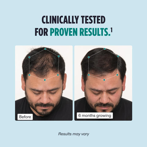 Nutrafol Men’s Hair Growth Supplement | Thicker, Stronger Hair - 120 Capsules